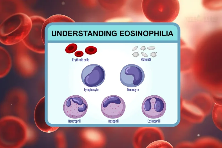 Understanding Eosinophilia: Causes, Normal Ranges, Symptoms & Natural Remedies